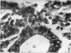 476-1