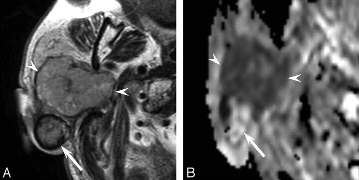 Fig 2.