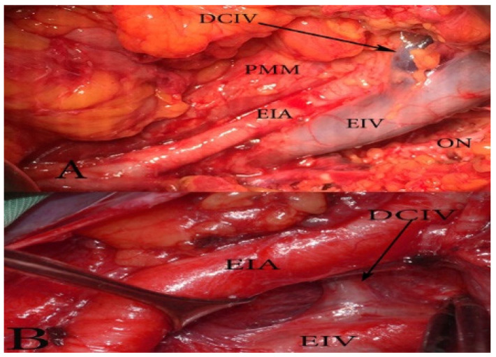 Figure 16