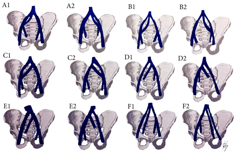 Figure 13