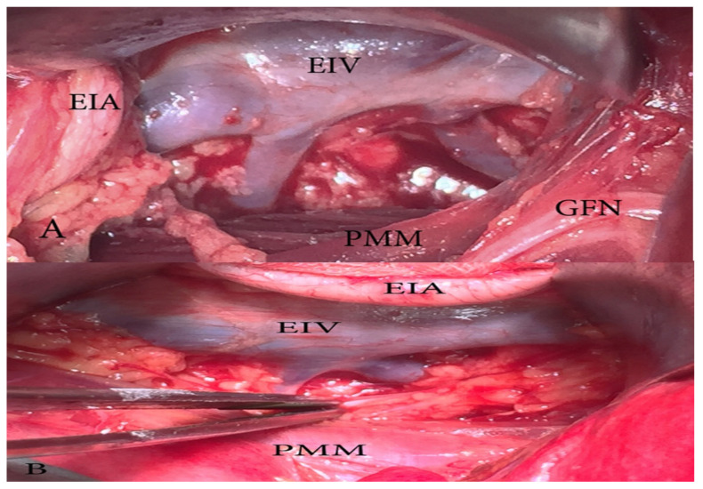 Figure 15