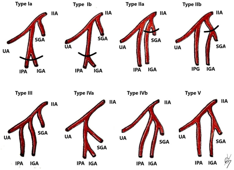 Figure 10