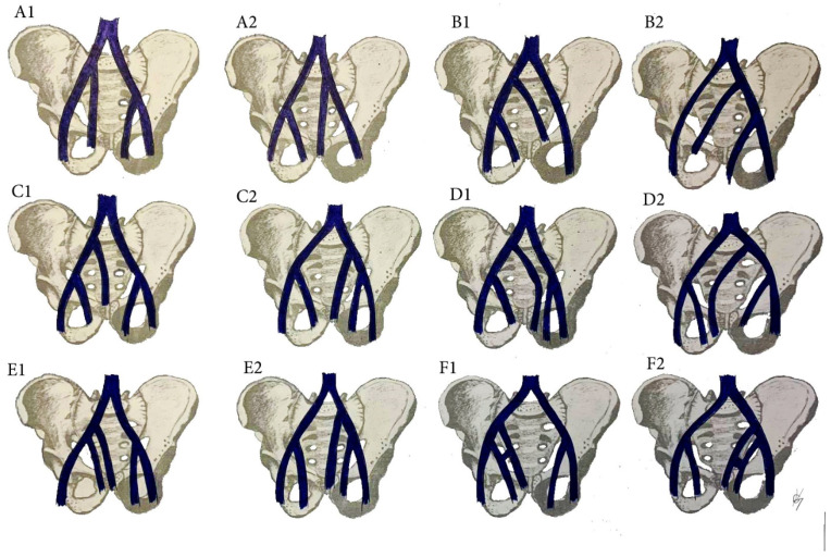 Figure 17