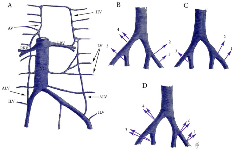 Figure 14