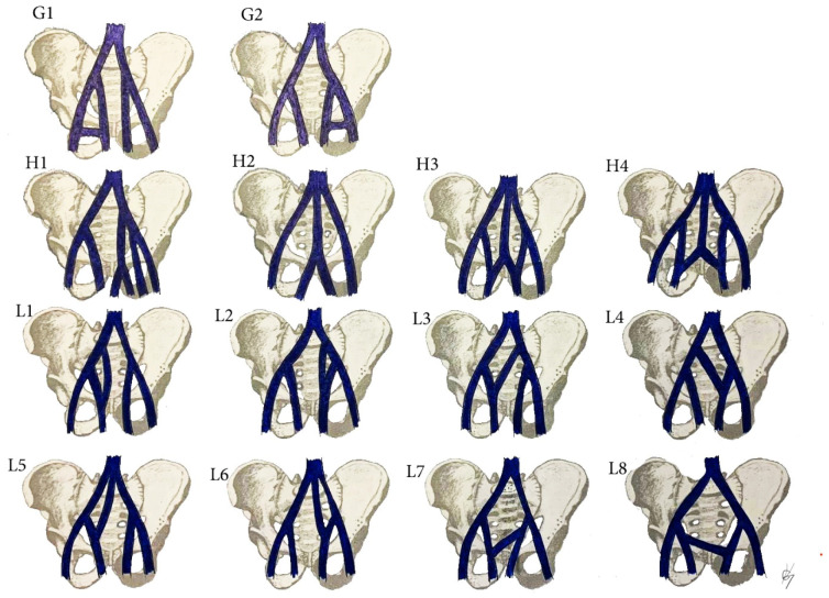 Figure 18