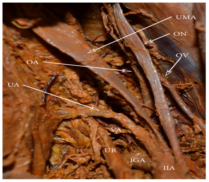 Figure 11