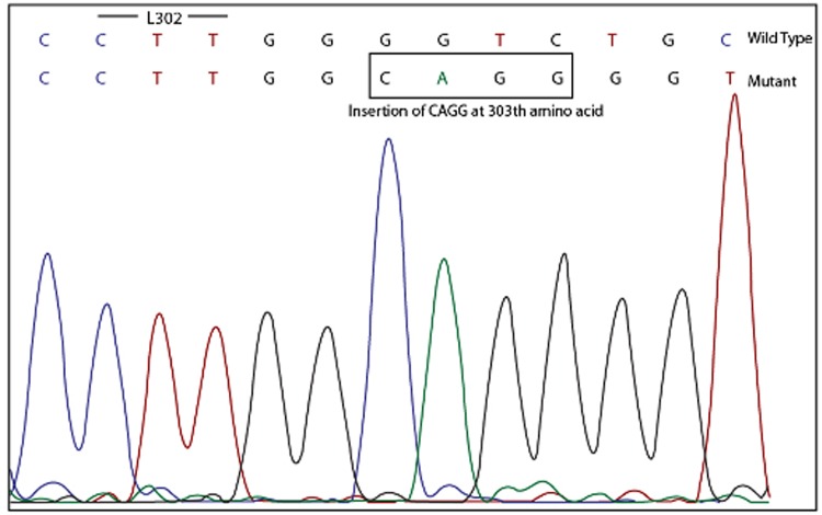 Fig 1