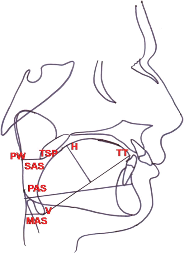 Fig. 1