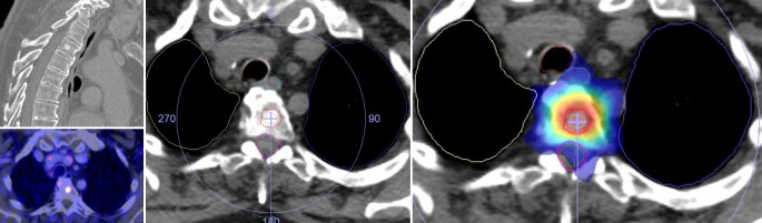 graphic file with name 120_2022_1966_Fig2_HTML.jpg