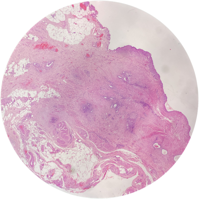 Fig. 3