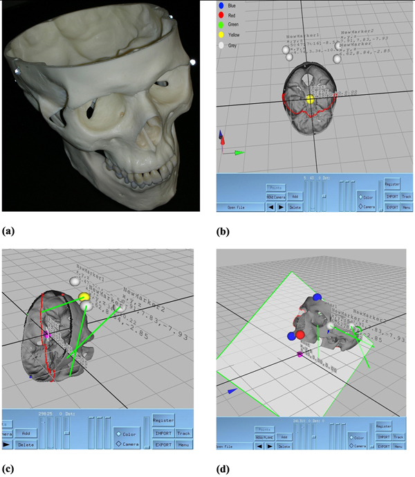 Figure 14