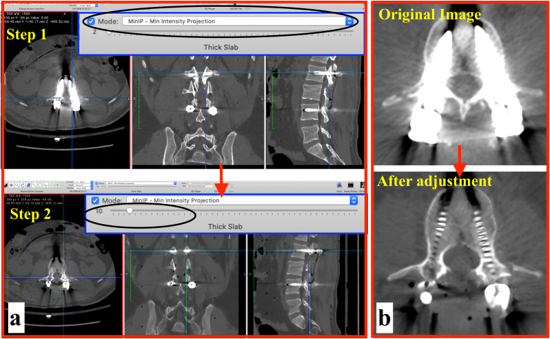 Fig. 2