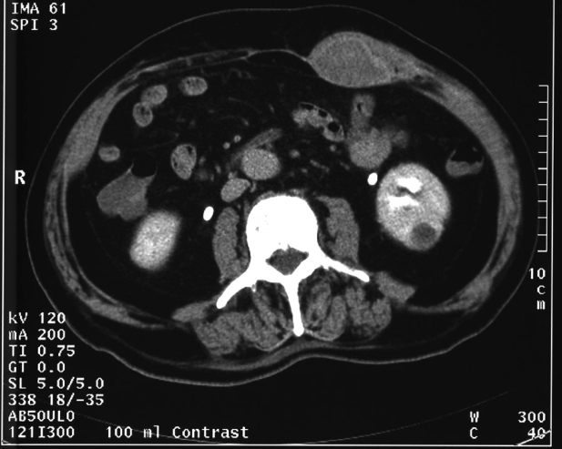 Figure 1:
