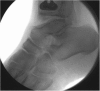 Fig. 12-C