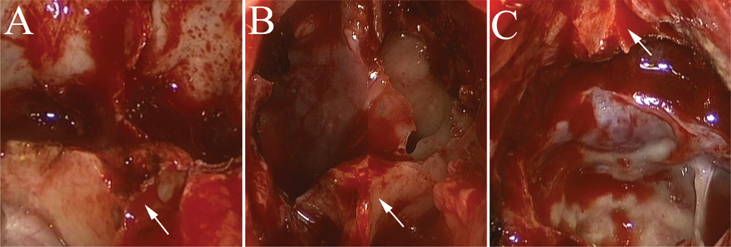 Fig. 11