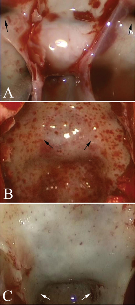 Fig. 12