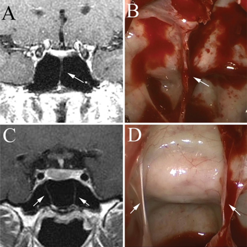 Fig. 10