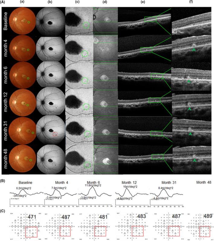 FIGURE 4