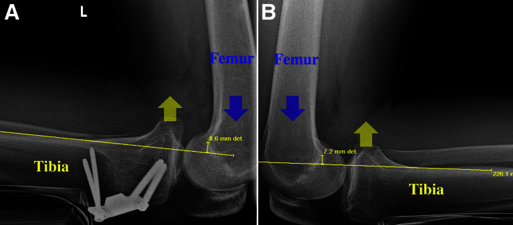 Fig 16