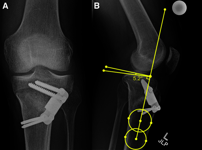 Fig 15