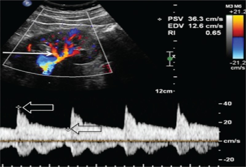 FIGURE 1