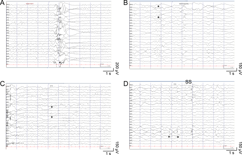 Figure 1: