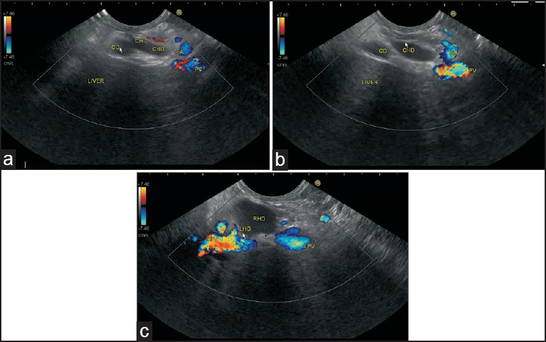 Figure 11