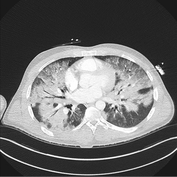 Figure 2