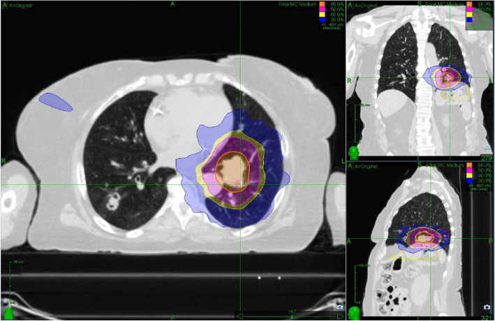 Fig. 2