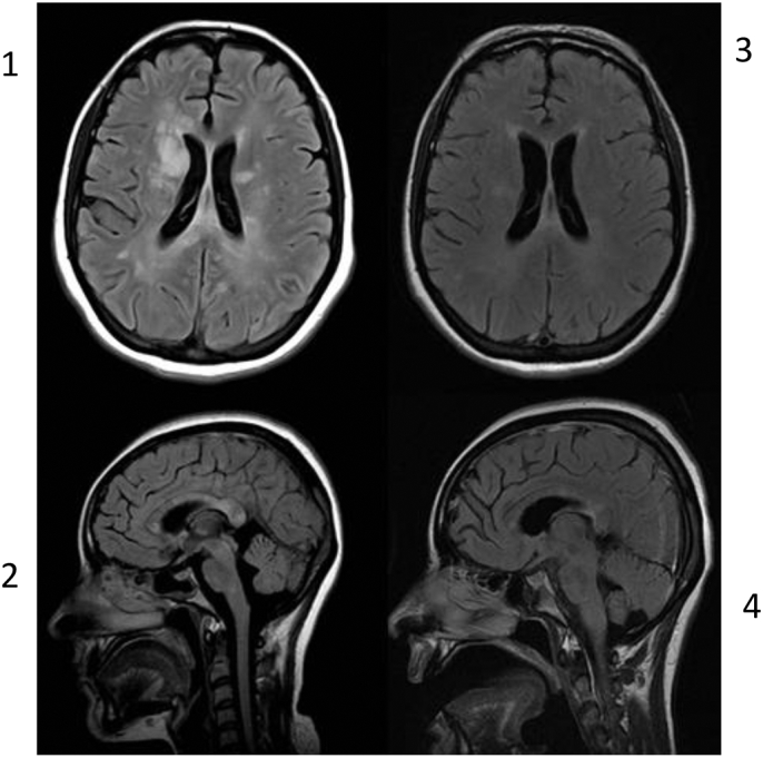 Fig. 1