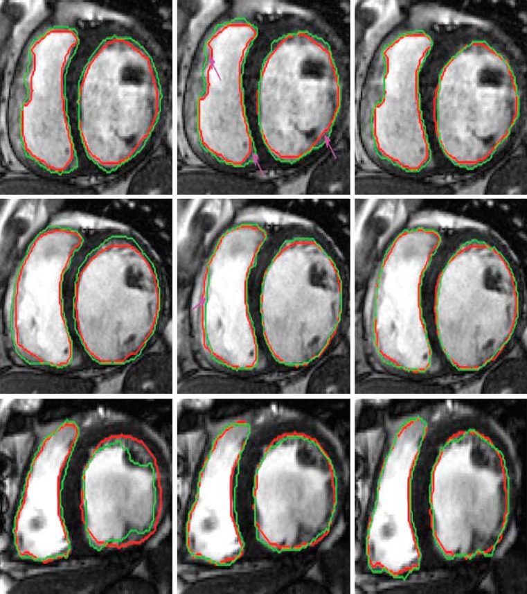 Fig. 4