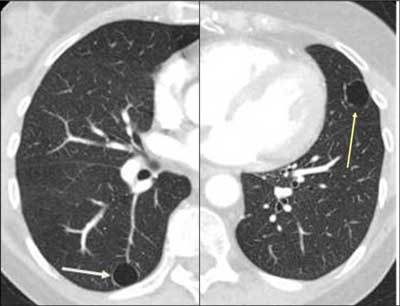 Figure 23