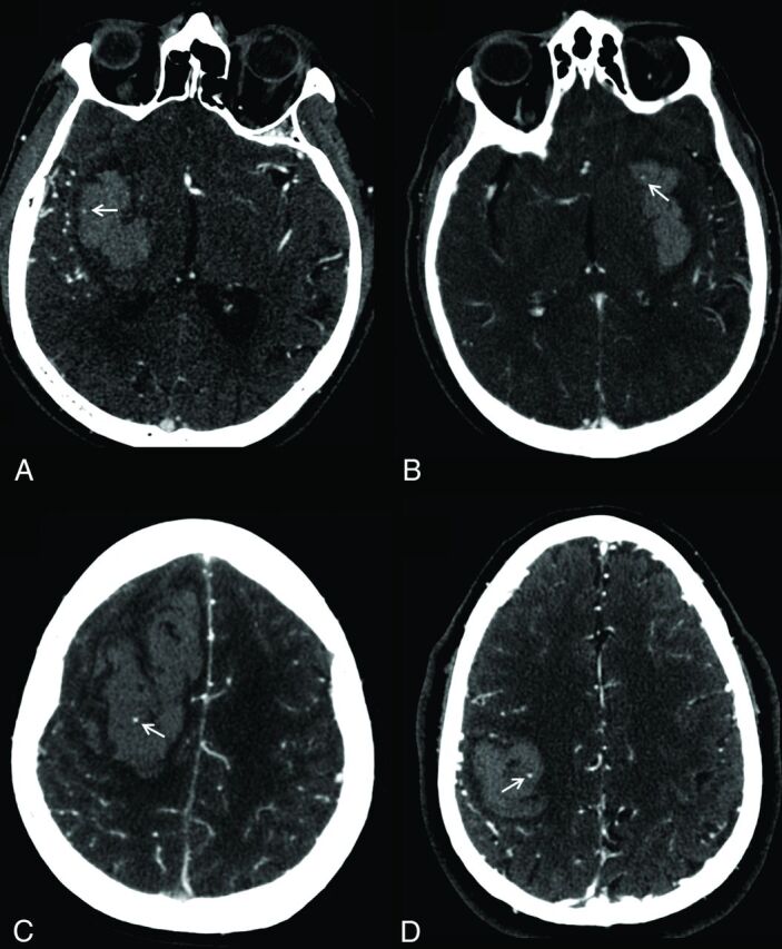 Fig 1.