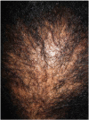 Fig. 13