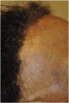 Fig. 15