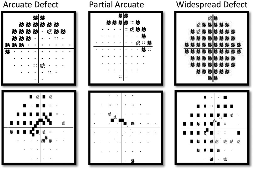 Agreement between 10-2 and 24-2C visual field test protocols for ...