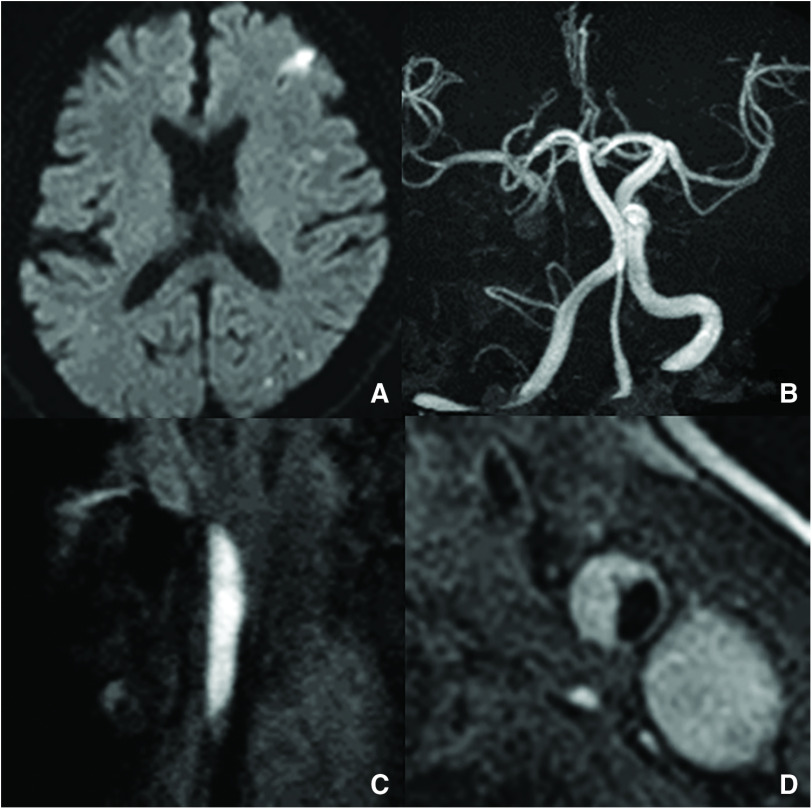 Fig. 1