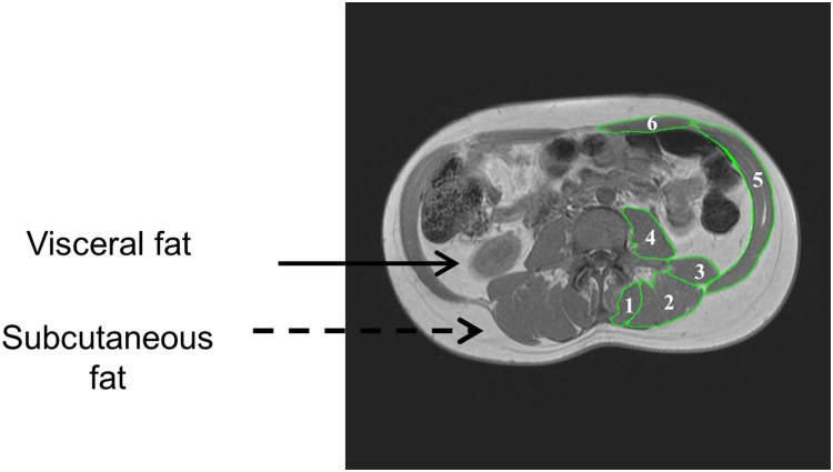 Figure
1