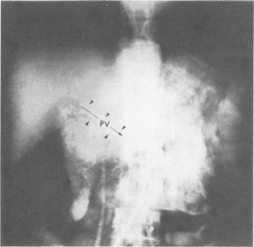 Fig. 17.