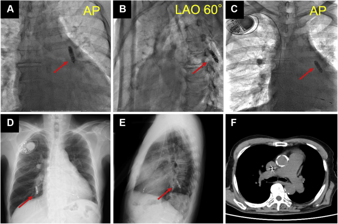 Figure 1