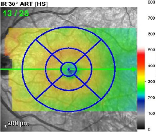 Fig 2