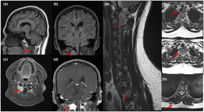 FIGURE 2