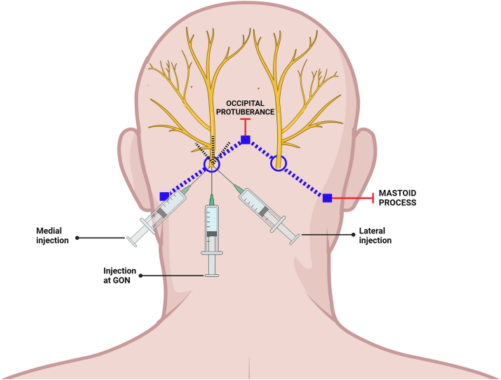 Fig 2