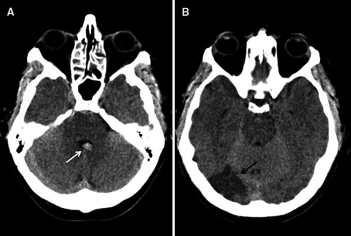 Fig. 1