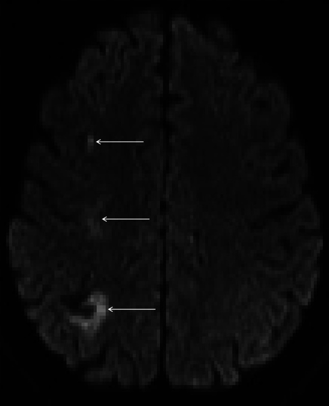 Fig. 3