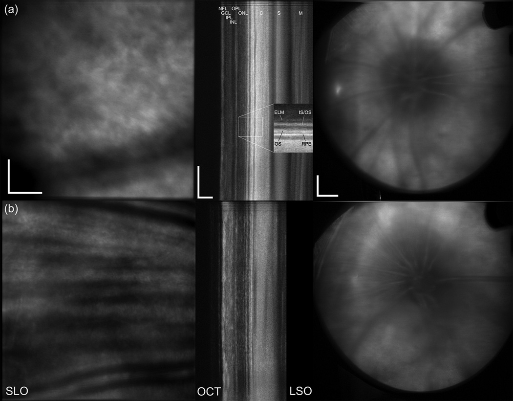 Fig. 12