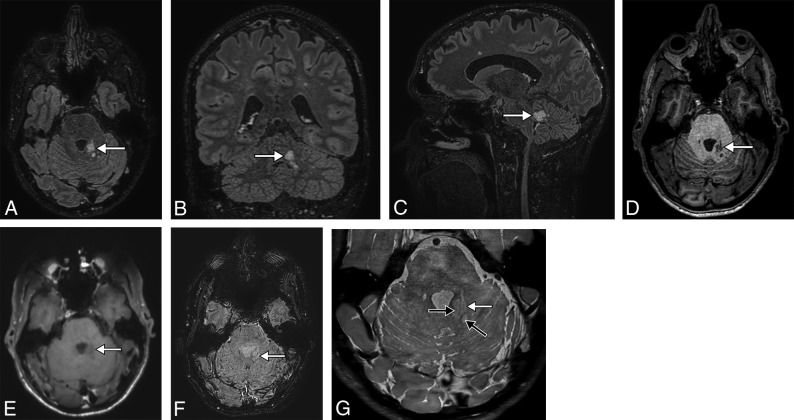 Fig 1.