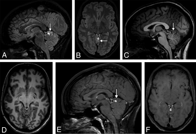 Fig 2.