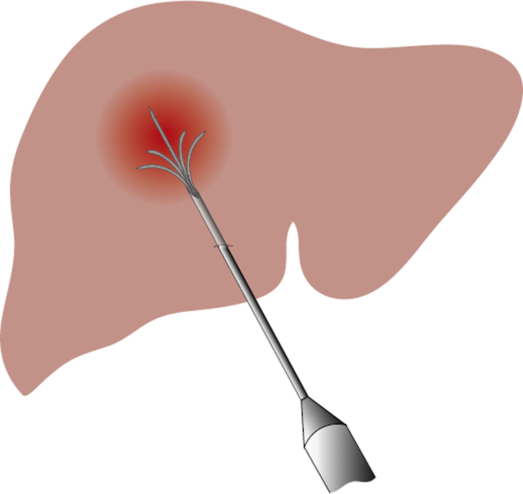 Fig. 13