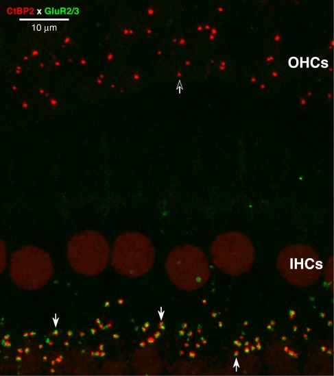 FIG. 10